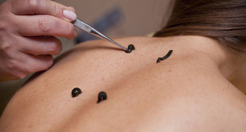 Традиционная медицина