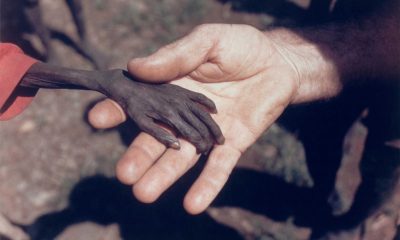 Болезненная рука голодающего ребенка