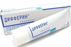 Дифферин 0