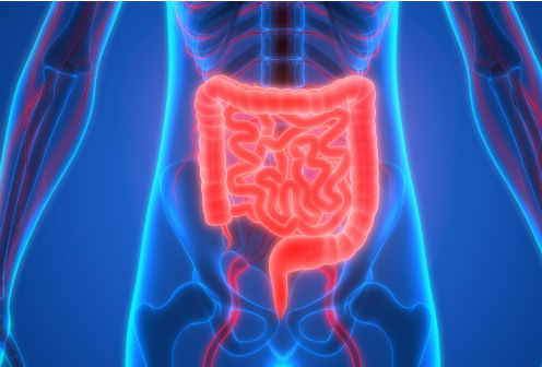 Неспецифический язвенный колит