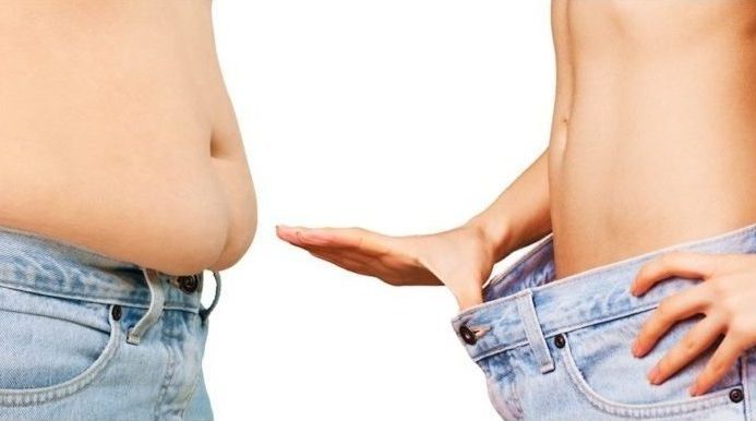 Липосакция