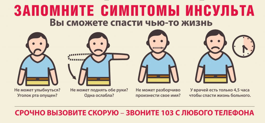 Запомните симптомы инсульта