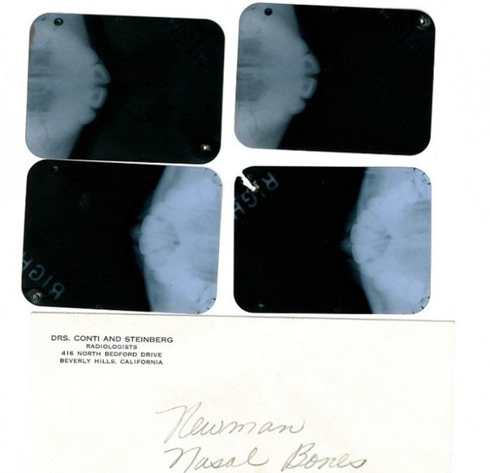 Рентгеновский снимок зубов Мэрилин Монро