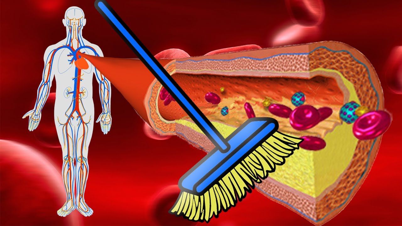 Очистка кровеносных сосудов