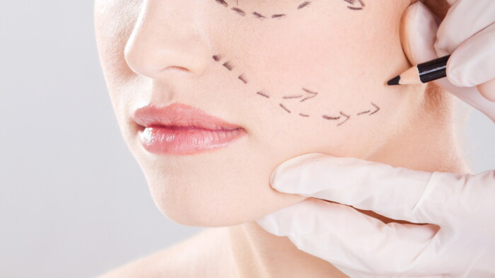 Эндоскопическая подтяжка