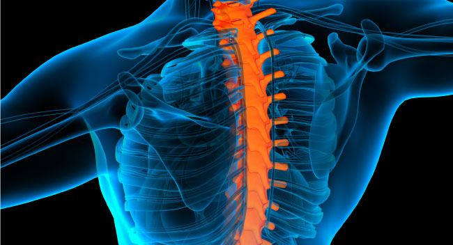 корешковый синдром