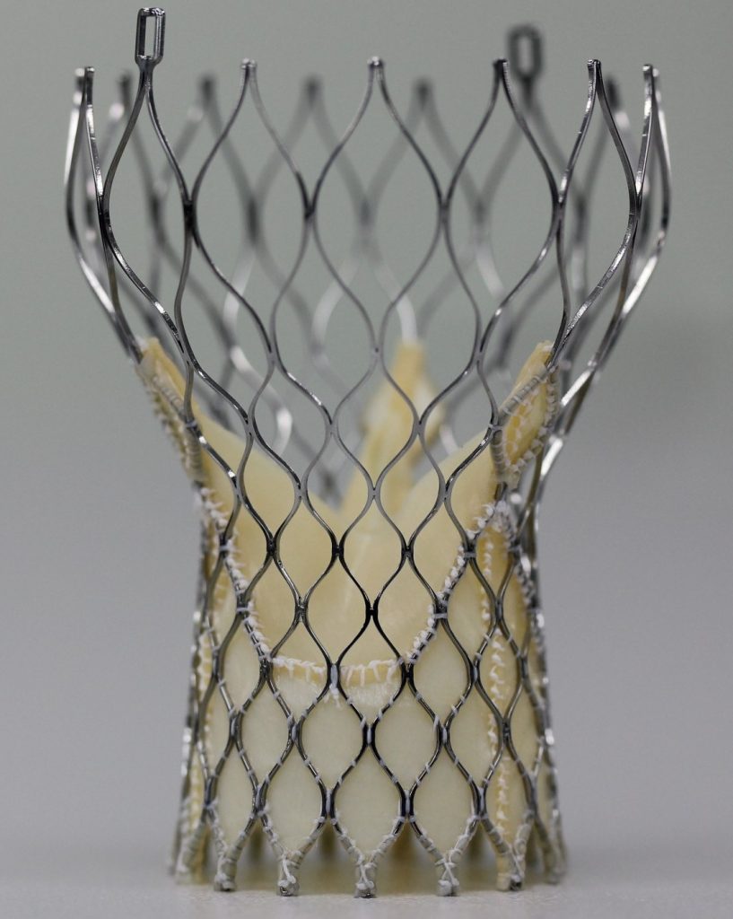 транскатетерное протезирование аортального клапана