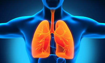 Хроническая обструктивная болезнь лёгких