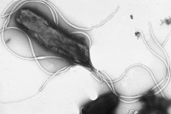 Бактерии Helicobacter Pylori (Хеликобактер пилори)