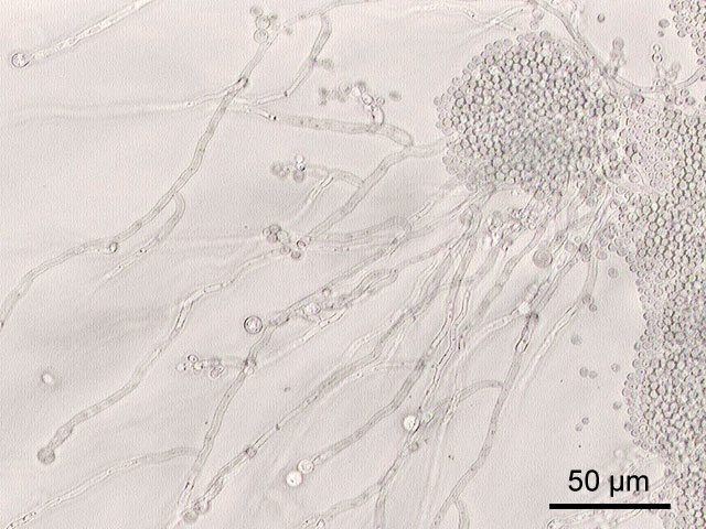 Candida albicans — диплоидный грибок (форма дрожжеподобных грибов), существующих в кишечнике