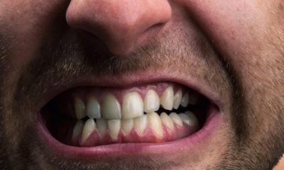 Путь к мужскому сердцу лежит через зубы, считают стоматологи