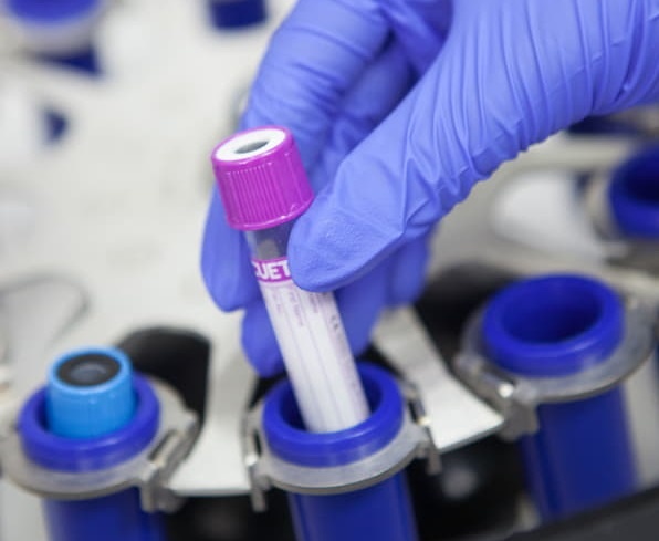 ИНВИТРО объявляет о старте новой волны экспедиции доноров костного мозга