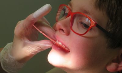 Ребенок Стоматолог Зубы Прикус