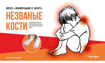 ФОП Незваные кости