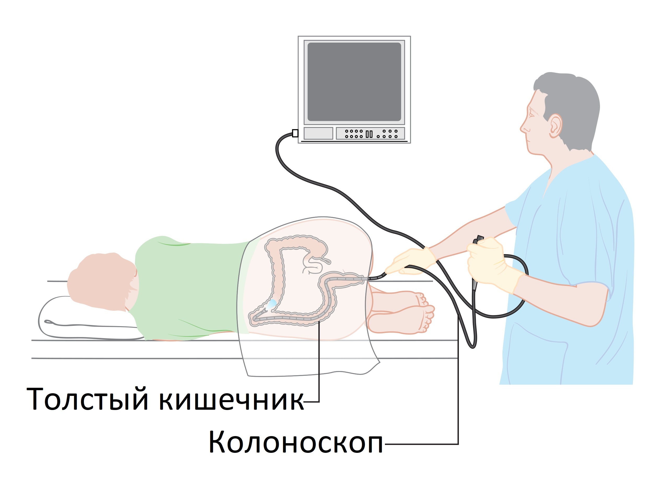 Стоит делать колоноскопию