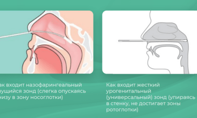 назофарингеальный гнущийся зонд