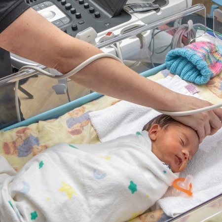 УЗИ Новорожденный