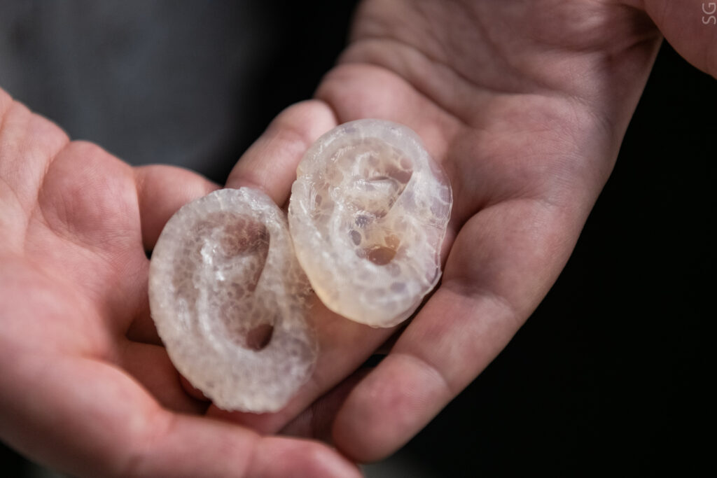 НИТУ МИСиС протез ухо