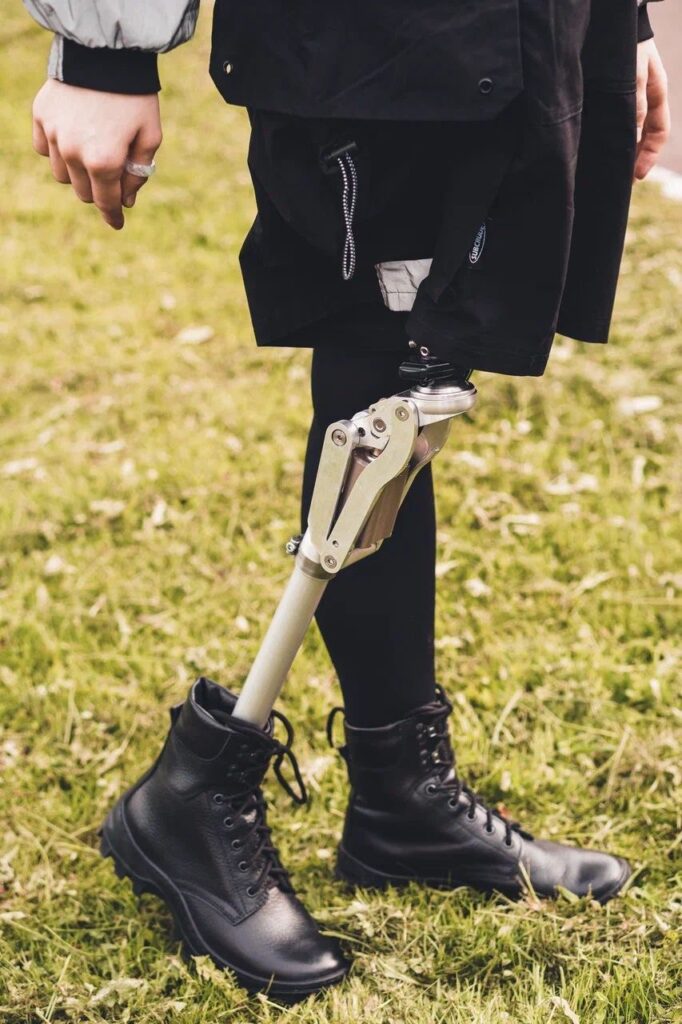 Протез колена