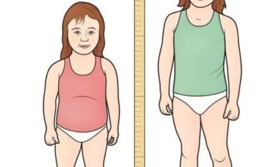 Дефицит гормона роста у детей