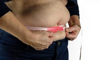 Ожирение Лишний вес