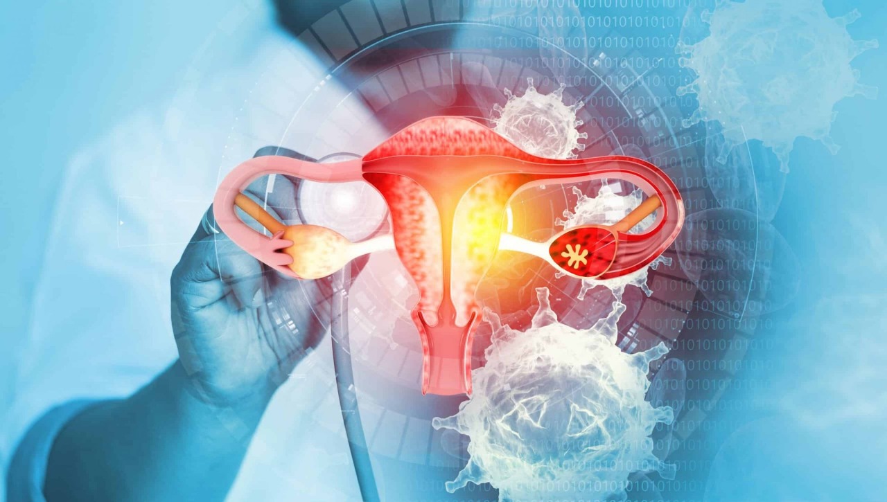 Inflamado cuello uterino sano