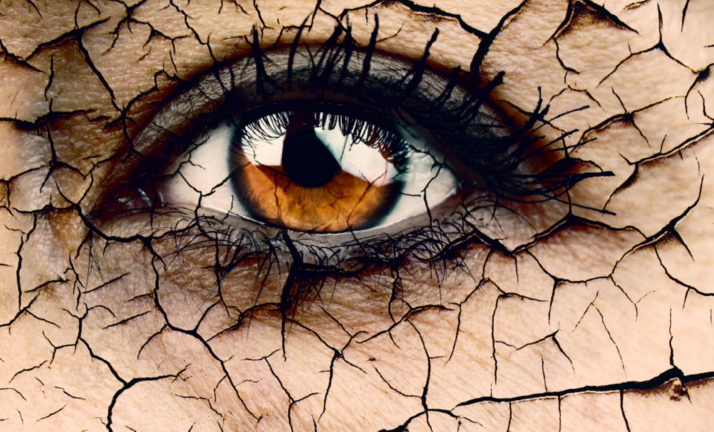 Сухой глаз