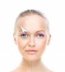 Лазерная шлифовка лица Косметология