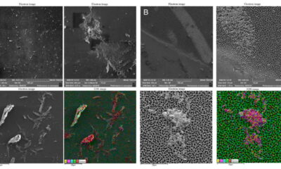 СЭМ-изображения клеток на поверхности пористых пластин