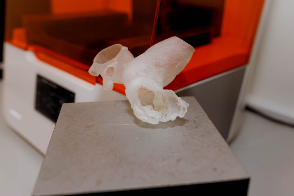 3D-модель с особенностями из-за кальцификации органа и расслоения стенки