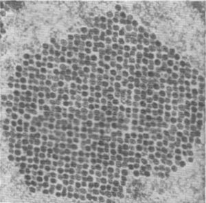 Рис. 4. Внутриядерное кристаллоподобное скопление аденовирусов (срез контрастирован уранилацетатом).