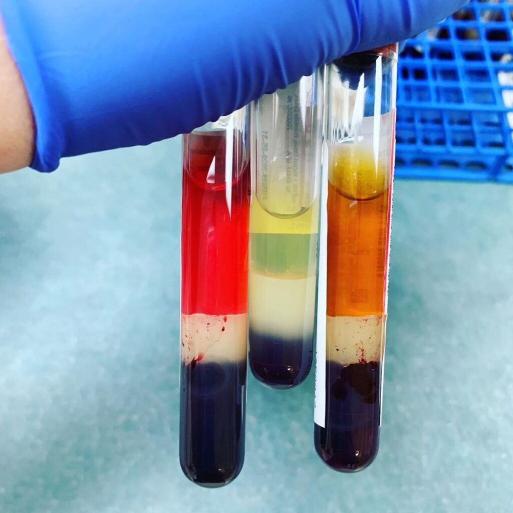 Лабораторные исследования