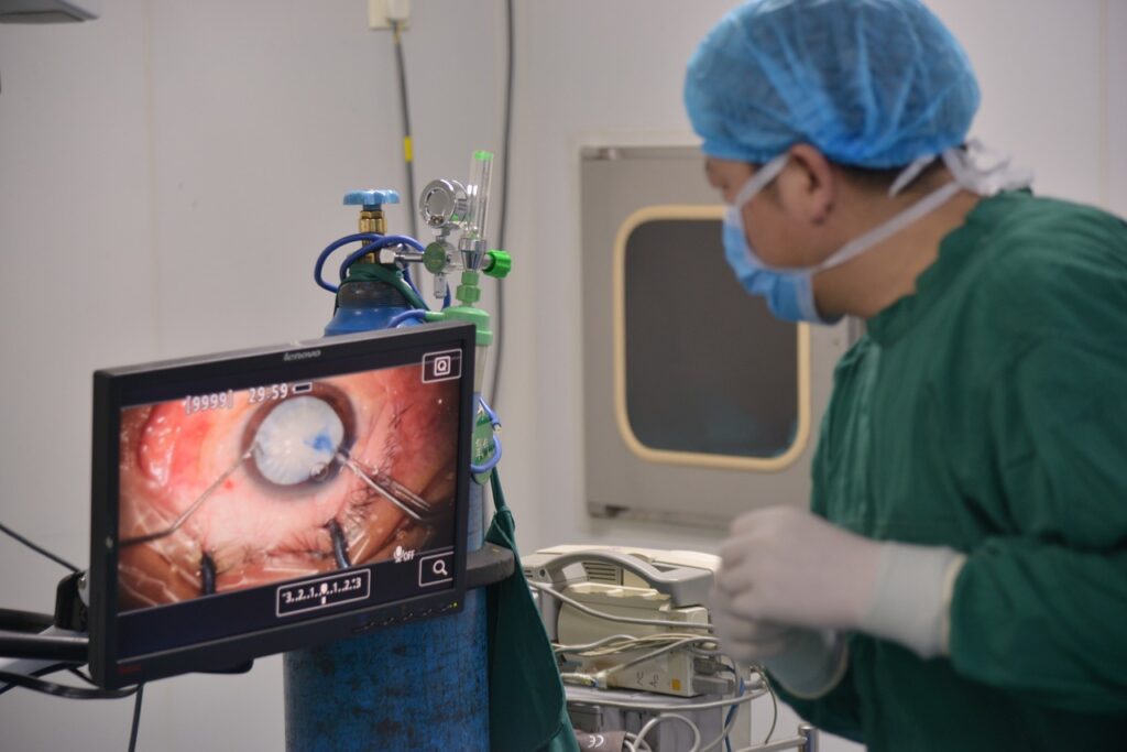 Разрыв катаракты, Операция по удалению катаракты, Офтальмолог