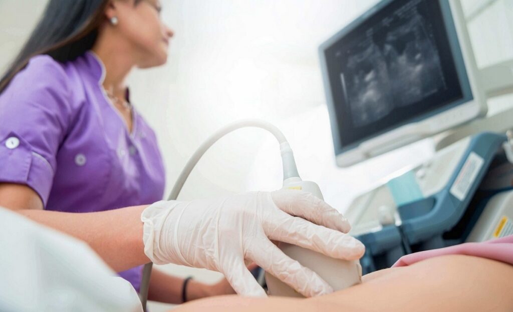 УЗИ малого таза