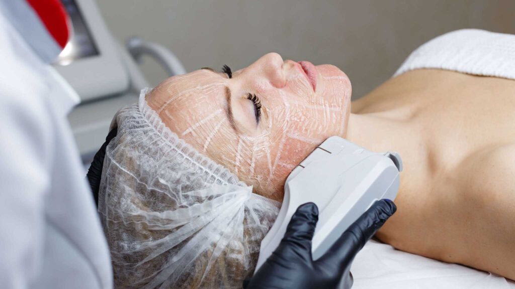 СМАС-лифтинг