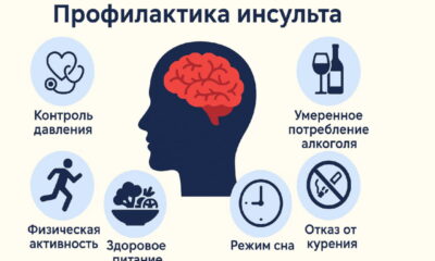 Профилактика инсульта