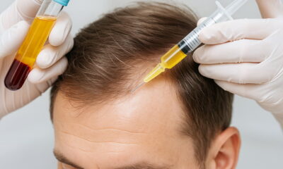 Плазмотерапия волос PRP