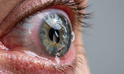 Почему в контактных линзах нельзя даже мыться