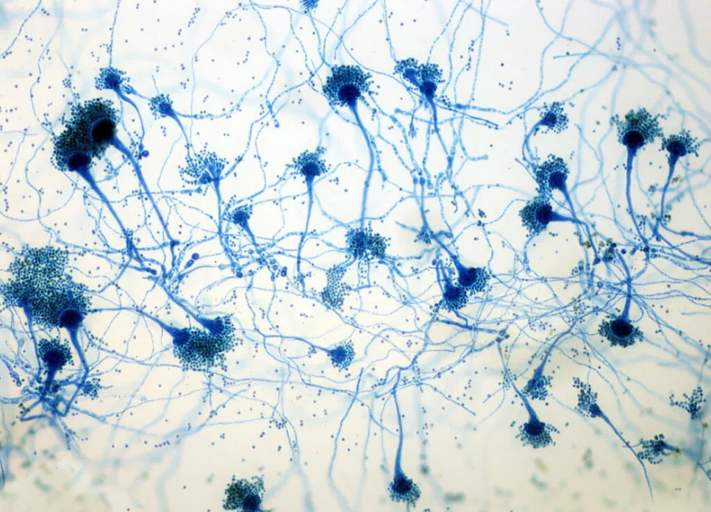 Aspergillus fumigatus